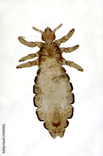 head lice