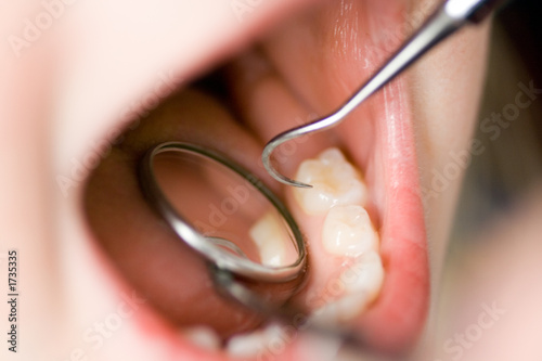 inspecting a child's teeth