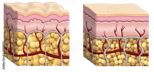 cellulite cross section