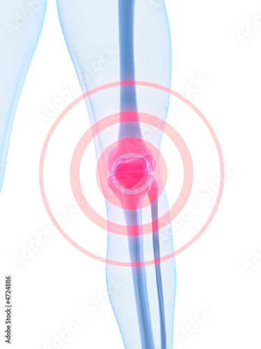 knie mit schmerzen