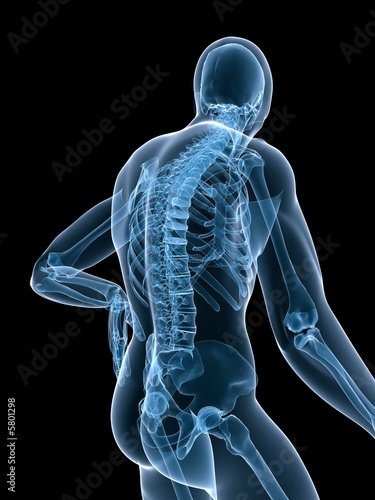 menschliche anatomy mit rückenschmerzen