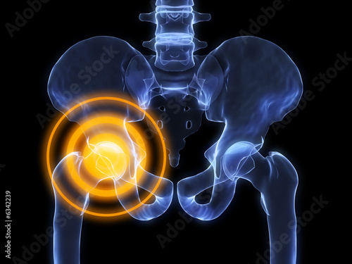 röntgenaufnahme hüftschmerzen