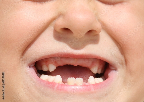 Child's toothless mouth