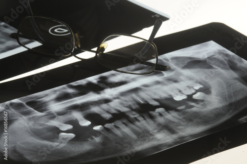 Ortopantomografia panoramica