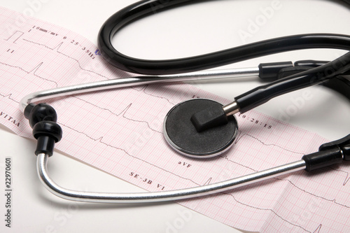 Wydruk EKG z przychodni zdrowia i stetoskop