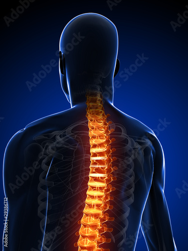 menschliche Anatomie - Rückenschmerz