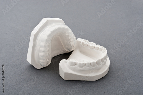 Dental plaster mold