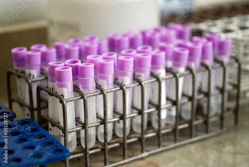 test tubes in laboratory; shallow depth of field;