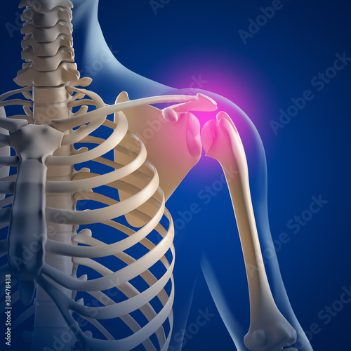 Schulter-Schmerzen - 3D Grafik