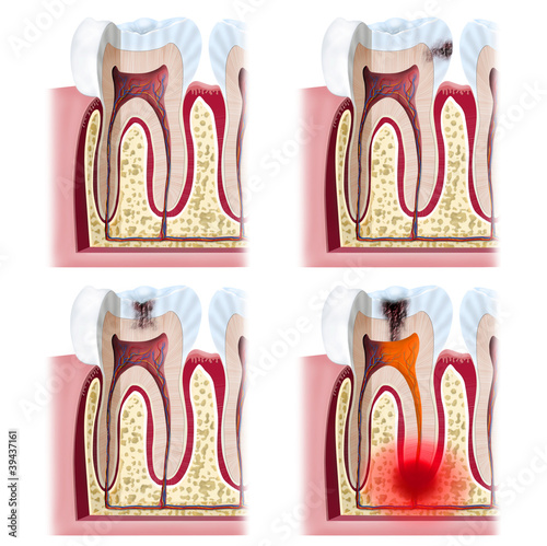 Dental Problems x4