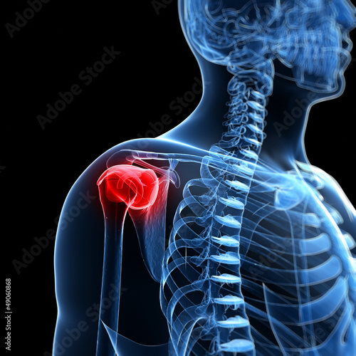 3d rendered illustration of a painful shoulder