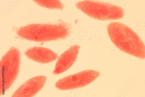 animal conjugation of Paramecium caudatum