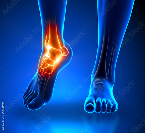 Ankle pain - detail