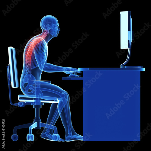 3d rendered medical illustration - wrong sitting posture