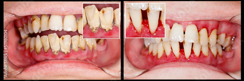 Before and After Treatment