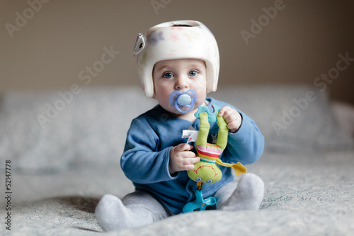 baby with helment for Plagiocephaly