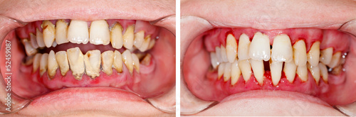 Before and After Treatment