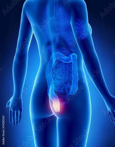 Female HEMORRHOIDS concept x-ray posterior view