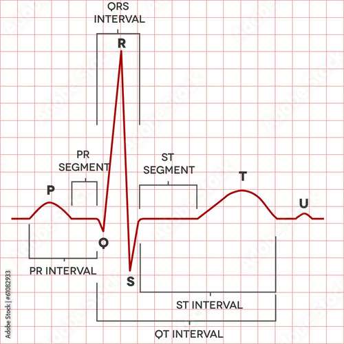 Human heart normal sinus rhythm, electrocardiogram