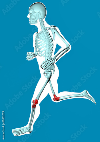 Uomo che corre visto ai raggi x con dolore ginocchia