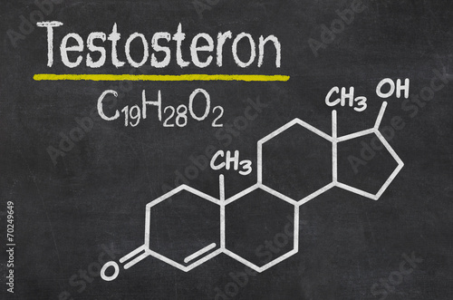 Schiefertafel mit der chemischen Formel von Testosteron