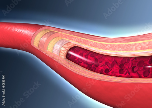 Aufbau einerArterie