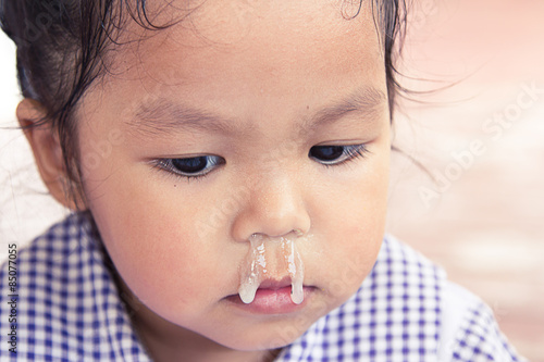 little girl with snot flowing from her nose