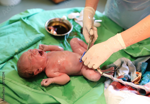 Newborn baby after birth in hospital