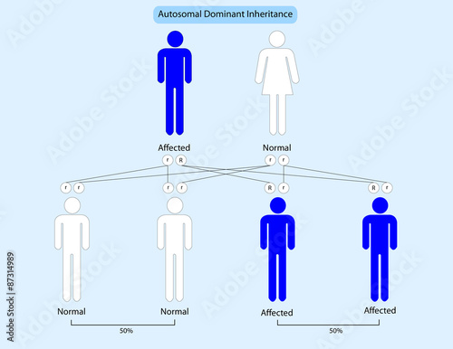 Autosomal dominant inheritance