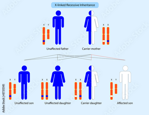 X-linked recessive inheritance