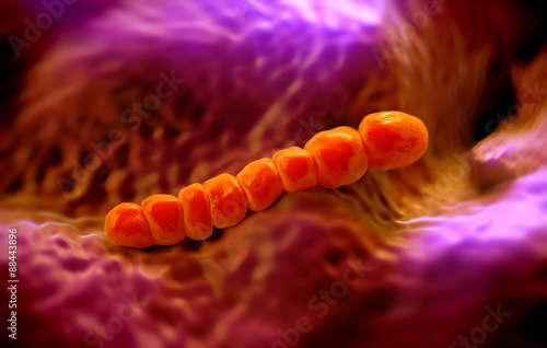  Streptococcus pneumoniae, or pneumococcus