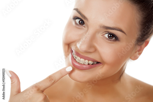smiling young woman pointing a finger on her braces