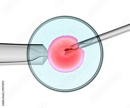 artificial insemination