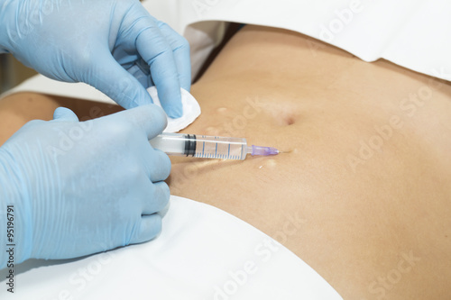 woman is in the process cellulite mesotherapy clinic