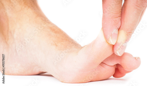 Male person pulling big toe backwards isolated towards white