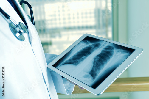 doctor observing a chest radiograph in a tablet