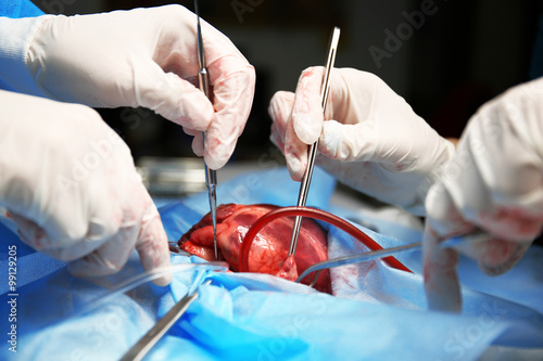 Doctor doing heart operation