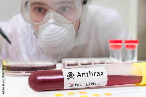 Scientist is analyting blood sample for Anthrax.