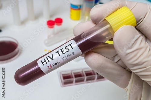 Hand holds test tube for HIV test.