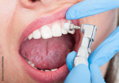 Closeup of female patient having teeth examination