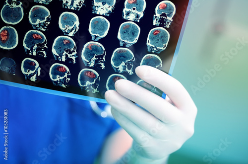 Doctor attentively examines the MRI scan of the patient