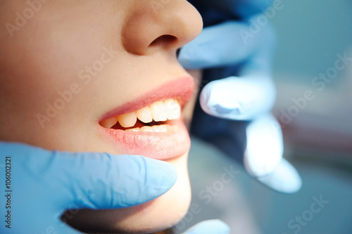 teeth of a beautiful girl closeup. girl at the dentist