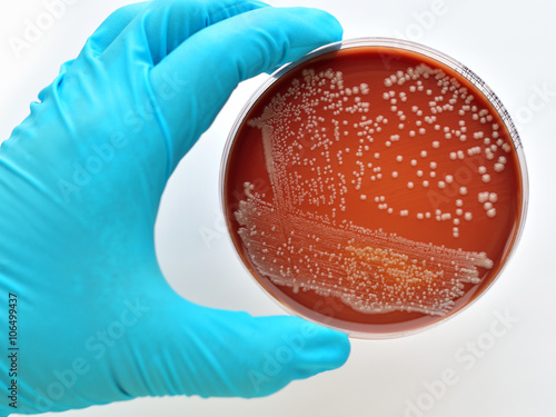 Colonies of bacteria in culture medium plate 