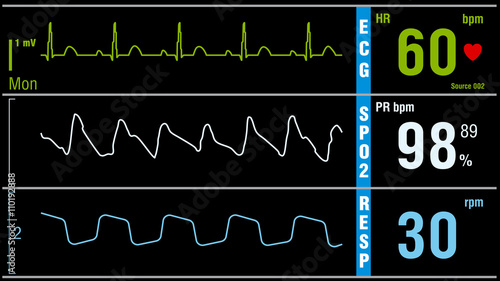 Patient monitor displays vital signs ECG electrocardiogram EKG, oxygen saturation SPO2 and respiration. Medical examination vector illustration.