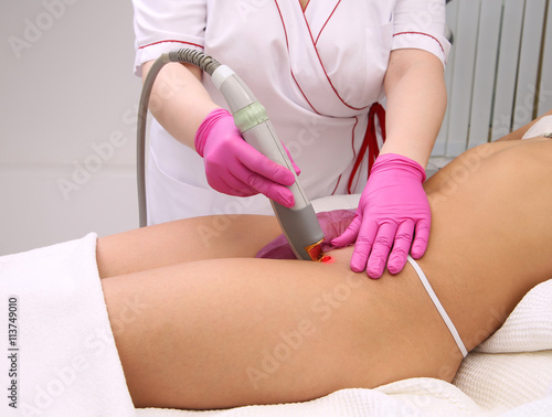 Laser hair removal.