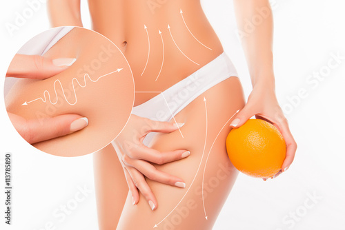 No to cellulite! Close up photo collage of woman showing her sk