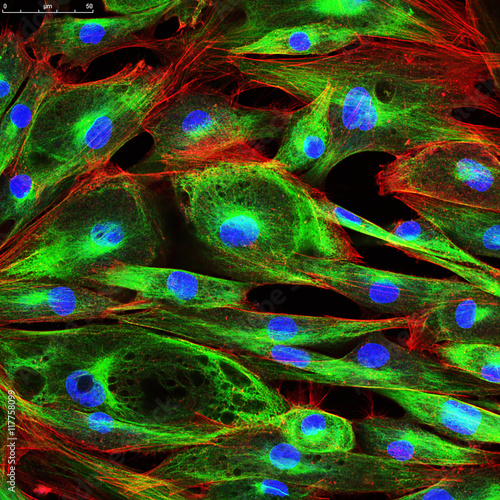 Confocal microscopy of fibroblast cells