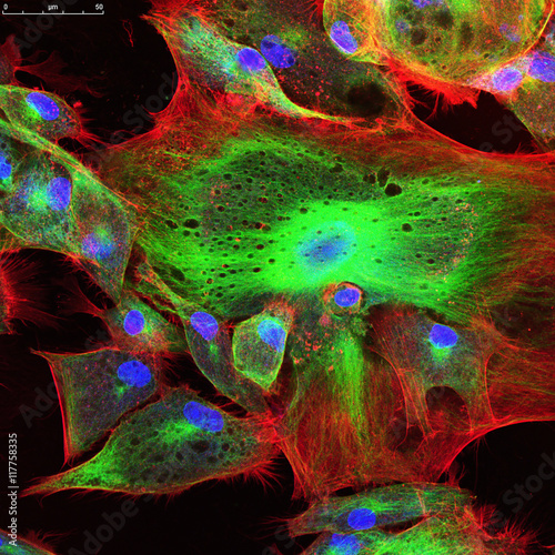 Confocal microscopy of fibroblast cells