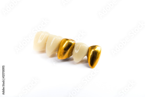 Dental ceramic and gold tooth crowns on white background. Isolated.