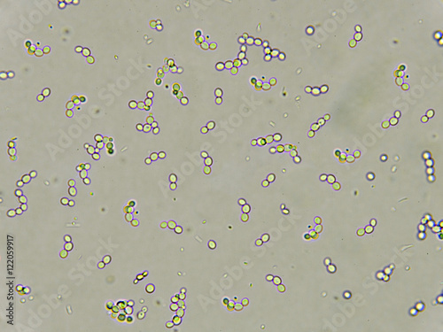 Budding yeast cells in urine, analyze by microscope 